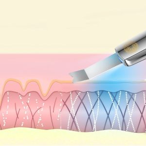 КАВИТАЦИОНЕН ПИЛИНГ 5 В 1 - LUMINEO PRO LINE + ЛИФТИНГ ТОНИК 400 мл