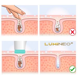 ЧЕТКА ЗА ЛИЦЕ 3 В 1 - LUMINEO HOME SPA + ГЕЛ ЗА ВСИЧКИ ТИПОВЕ КОЖА 100 мл